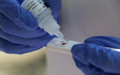 Hospital General de México invita a realizarse la prueba de  hepatitis C