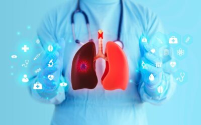 Aprueban en México nuevas indicaciones terapéuticas para cáncer de pulmón