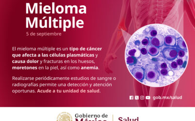 Avances médicos duplican sobrevida de personas con mieloma múltiple